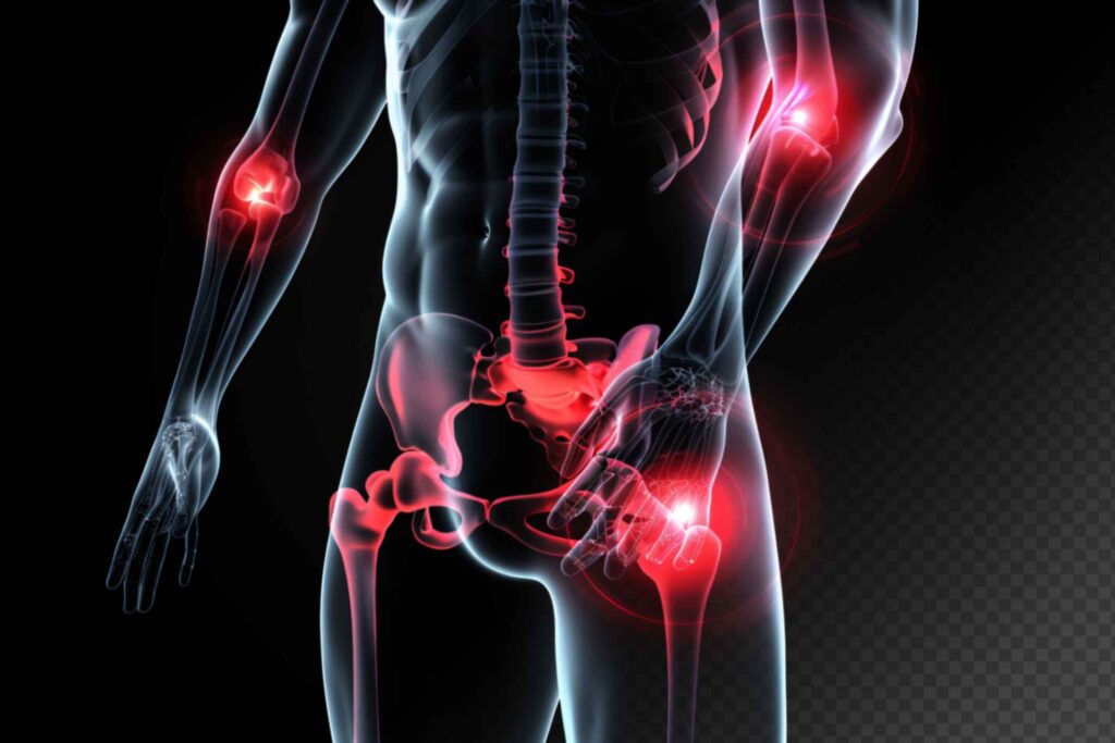 Joint Pain Relief: Best Practices for Managing Chronic Pain