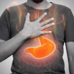 Causes, symptoms and treatment for acidity