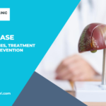 Liver Disease Symptoms, Causes, Treatment Options, and Prevention Strategies