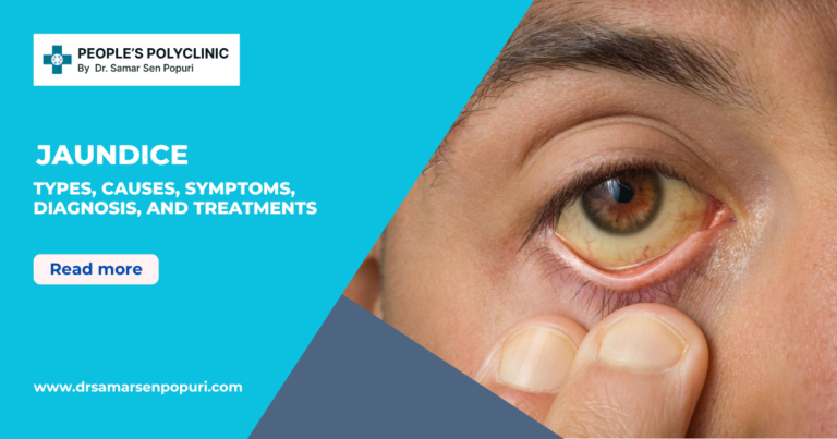 Understanding Jaundice Types, Causes, Symptoms, Diagnosis, and Treatments