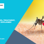 Malaria: Symptoms, Causes, Treatment, and Prevention Explained