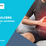 Understanding Stomach (Peptic) Ulcers: Causes, Symptoms, Diagnosis, and Treatments