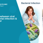 Symptoms Comparison: Viral vs Bacterial vs Dengue