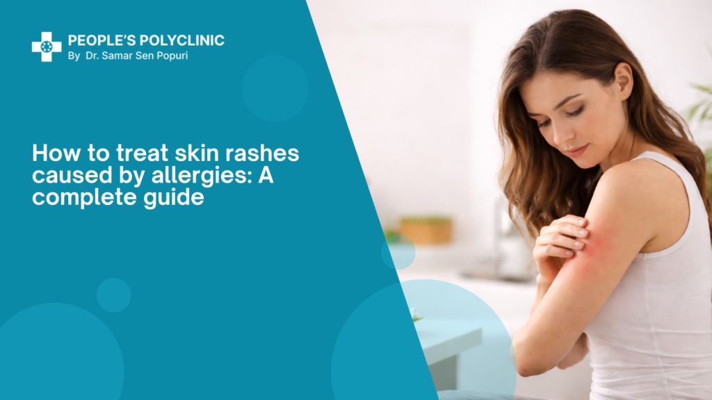 Common Skin Allergy Symptoms