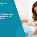 Common Skin Allergy Symptoms